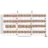 Boquês de Sílabas  Complexas - MDB